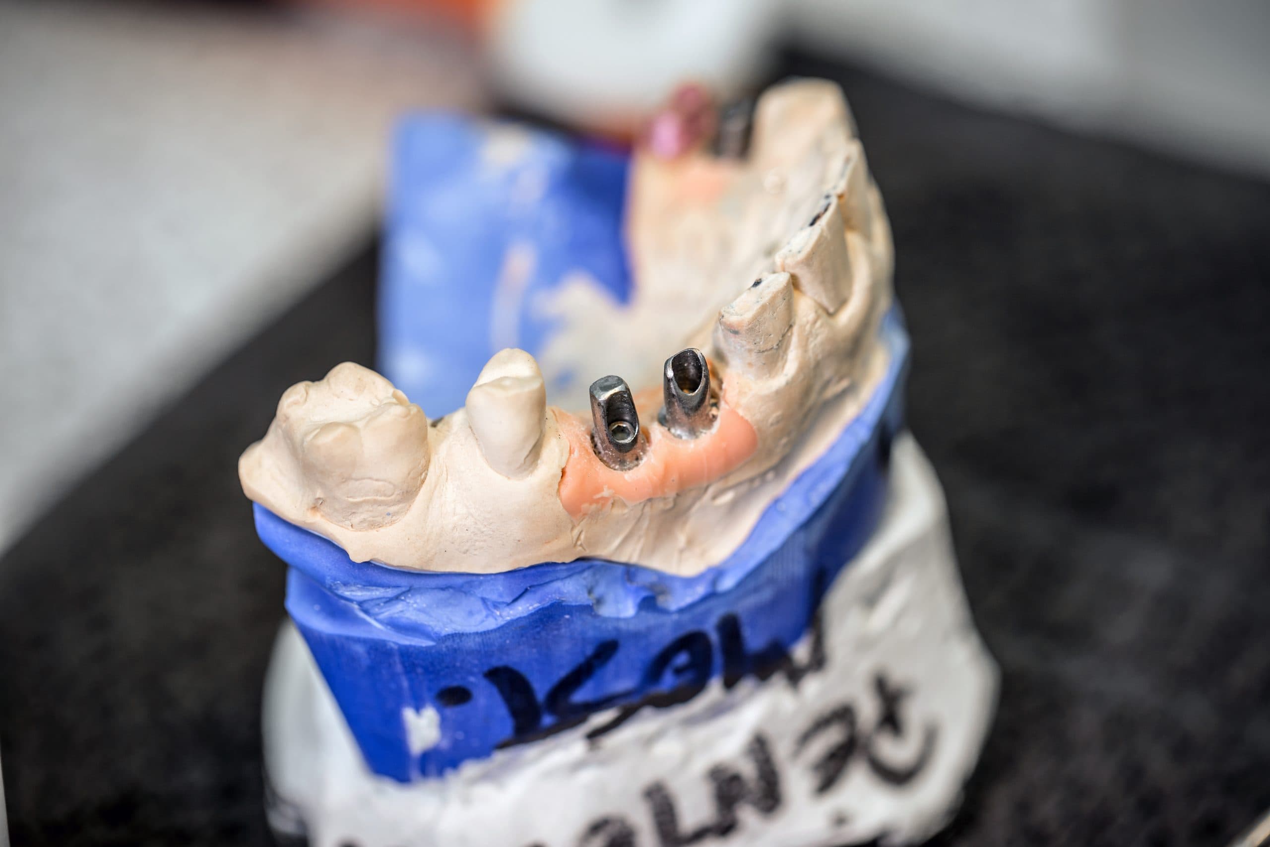 Implantes